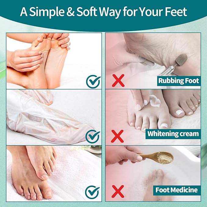 5 Pack Moisturizing Foot Mask,Hydrating Foot Masks for Dry Cracked Feet,Moisturizing Socks Dry Skin Moisturizer for Soft and Smooth Touch Feet,Foot Care Spa Gifts for Women Men Mothers Day Gifts