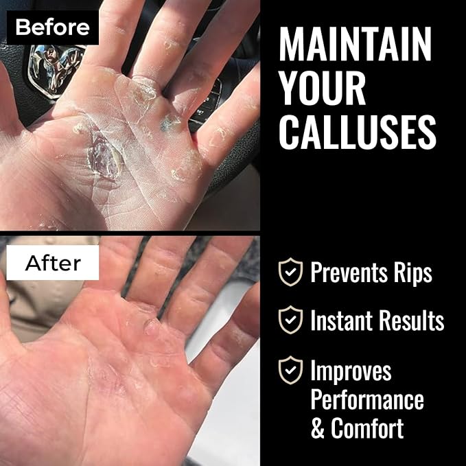 SandBar Ultimate Callus Remover Set - 4" & 8" Files with Moisturizing Salve Balm Stick - Elevating Athletes, Weightlifters & Rock Climbers for Smoother Hands & Feet - Gold (Black) (Flat Black Bundle)