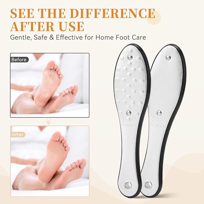Foot Callus Remover for Feet, Metal Foot File Scraper, Stainless Steel Dual Sided Pedicure Tool Professional Rasp for Hard Skin, Cracked Heels, Wet Dry Use