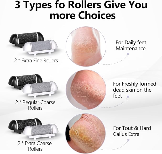 6 Pack Replacement Roller Refill Heads for Electric Foot Callus Remover, Electric Pedicure Tools Refill Heads with Extra, Regular, Fine Coarse 2 Each, Foot File Refill Roller