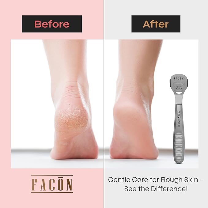 Facón Professional Callus Shaver Remover with 50 Blades, Pedicure Razor for Feet & Hands, Foot Razor for Callus Removal, Callus Blade Remover, Corn Shaver, Surgical Grade Premium Stainless Steel Tool