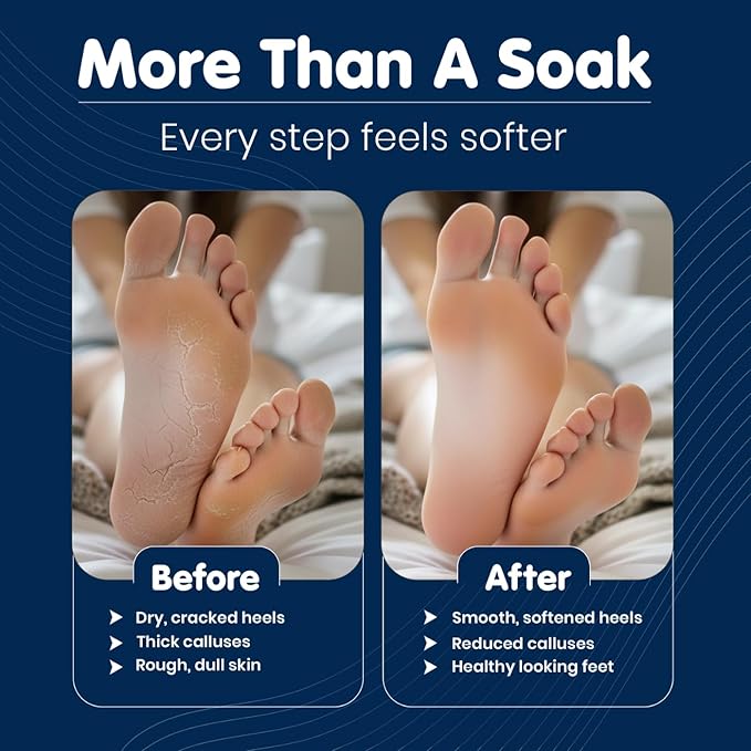 Imperial Feet Epsom Salt Foot Soak (PEDICURE GRADE)-Cracked Heels, Thick Calluses, Soften Hard Skin, Rough Feet & for Deeply Hydrates Dry Cracked Skin Foot Soak Salts with Turmeric 16oz (Orange Detox)