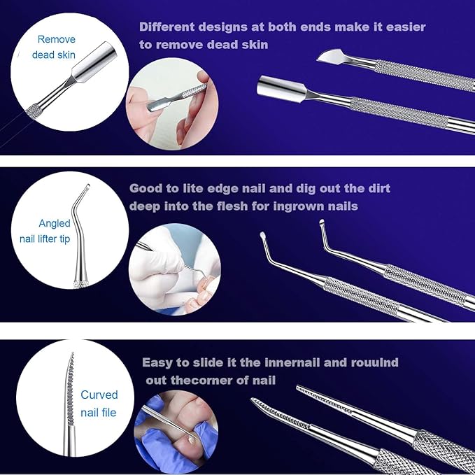Ingrown Toenail File and Lifters Set(9pcs), Ingrown Toenail Treatment Pedicure Kit, Under Nail Cleaner Tools