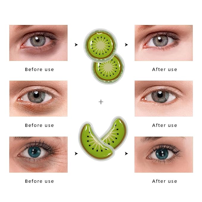 ZNÖCUETÖD Small Gel Ice Pack for Eye Pads and Under Eye Patches, Hot Cold Treatment Pack for Redness and Pain Relief (Kiwi)
