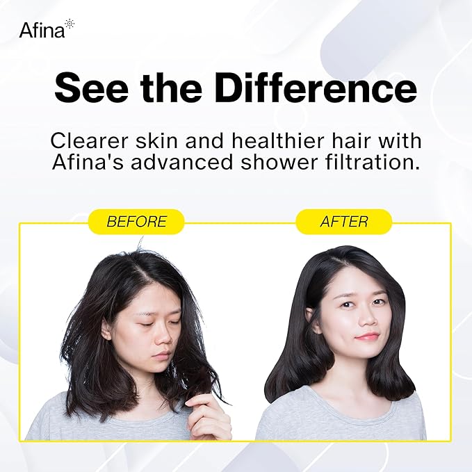 Afina Filtered Shower Head - Water Softener Showerhead with KDF-55 Shower Filter for Hard Water - High Pressure Rain Fall Experience - Universal Fit - Matte Black