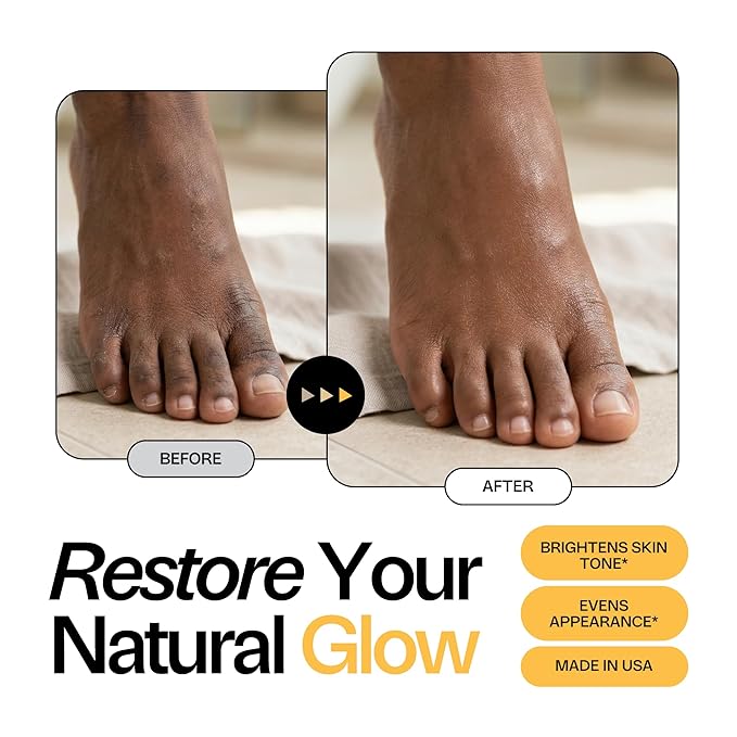 Skin Brightening Foot Soak with Kojic Acid & Niacinamide - Evens Skin Tone, Boosts Glow & Softens Calluses - Turmeric & Vitamin C - 1lb
