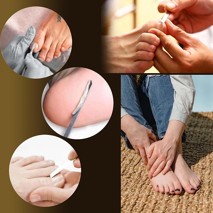 10PCS Toenail Clippers Tool, Ingrown toenail Tool, Professional Thick & Ingrown Toe Nail Clippers for Men & Seniors(red)