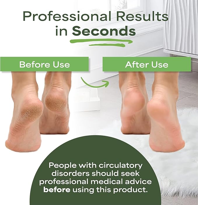 Professional Foot Scrubber Foot File for Dead Skin & Callus Remover - Extra Large Double Sided Pumice Stone for feet - Recommended by Podiatrists