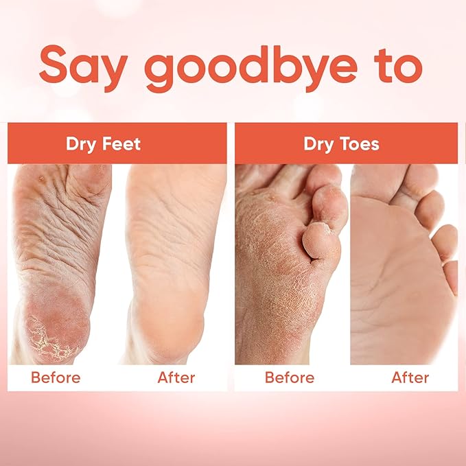 CÉLOR Foot Peeling Mask for Dry Cracked Feet | Foot Mask to Exfoliate Rough, Cracked, Dry Feet, Calluses for Soft Baby Feet Results | Made with Aloe Vera Extract for Women & Men (2 Pairs) | Peach
