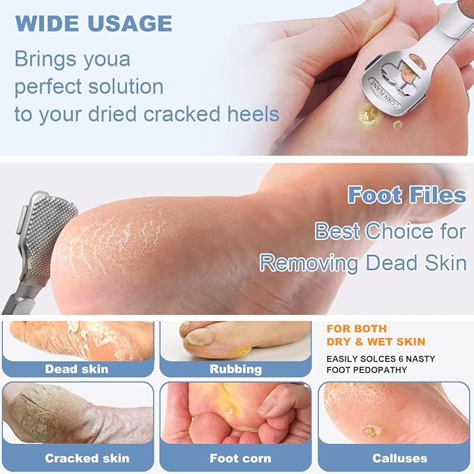 36 Pcs Callus Shaver for Feet Set, Foot Callus Shaver, (1 Stainless Foot File &1 Foot File Heads & 4 Pedicure Knife & 30 Replacement Slices Blades)