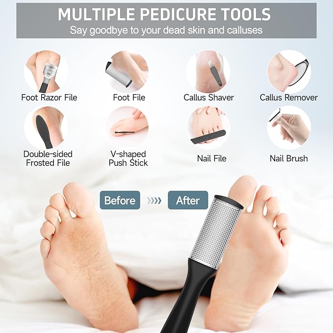 Electric Callus Remover for Feet,Professional Pedicure Kit Rechargeable Foot File Hard Skin Remover for Cracked Heels &Dead Skin,with 3 Roller Heads 2 Speed(White N9)