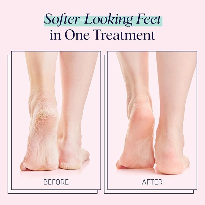 SpaLife Moisturizing Foot Sockies | Mothers Day Gifts & Foot Mask For Dry Cracked Feet | Tea Tree Oil Softening Booties | Callus Remover Alternative | Self Care Gifts for Women | 8 Pack