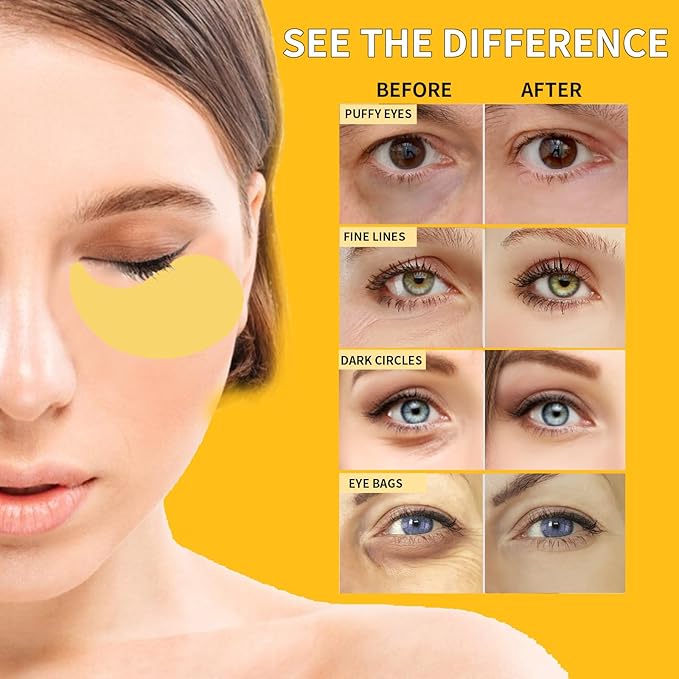 24K Gold Eye Masks for Dark Circles and Puffiness 70PCS, Under Eye Patches for Puffy Eyes Treatment, Under Eye Mask w/Caffeine, Hyaluronic Acid, Peptides for Eye Bags Treatment, Eye Mask Skincare