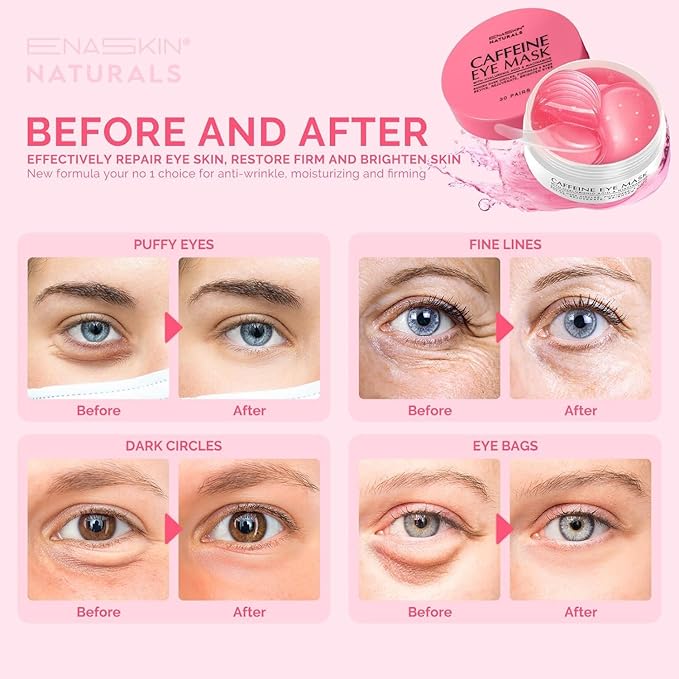 Under Eye Patches Kit: 120 Pcs Retinol & Caffieine Gel Eye Mask for Dark Circles, Puffiness and Wrinkles - Day & Night Skin Treatment Pads with Niacinamide, Collagen & Hyaluronic Acid (2 Pack)
