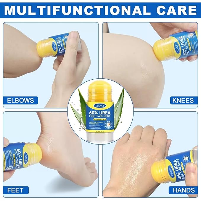 60% Urea Cream Stick plus 2% Salicylic Acid, Maximum Strength Urea Foot Cream Callus Remover for Dry Cracked Heels, Hands, Knees,Exfoliating Moisturizer, Dead Skin Remover Foot Balm 1.4oz (1 pack)