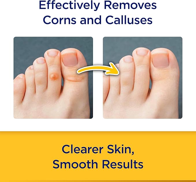CornStick Maximum Strength Salicylic Acid Solid-Stick Corn and Callus Remover 0.2 Oz