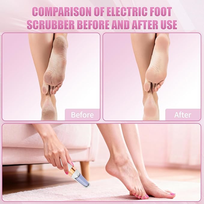 Pedicure Tool, Foot Callus Remover, Electric Pedicure Set, Foot Care, Removes Rough Dead Skin on The Feet, Making Your Feet Smooth.(White)