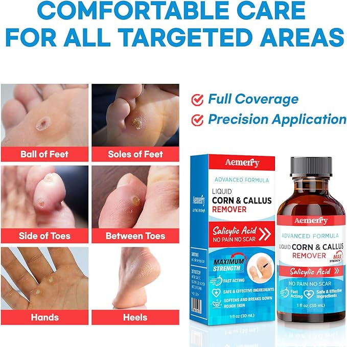 Aemerry Corn Removers for Toes Foot: Liquid Salicylic Acid 17% Corns Calluses Removal Extra Strength, Fast Acting Corn Remover for Feet Fingers. 30ml