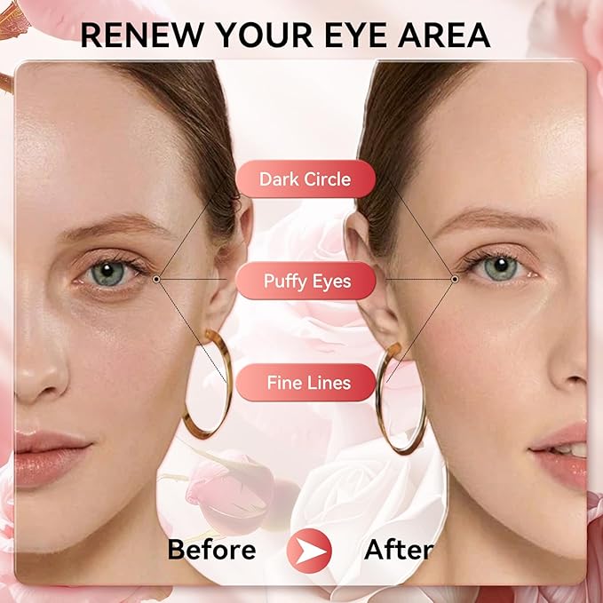 BREYLEE Rose Eye Mask, Under Eye Patches with Collagen & Hyaluronic Acid, Treat Puffy Eyes, Dark Circles, Wrinkles & Fine Lines, Smoothing Skin Care for Women & Men - 60 Pcs