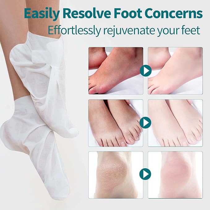 5 Pack Moisturizing Foot Mask,Hydrating Foot Masks for Dry Cracked Feet,Moisturizing Socks Dry Skin Moisturizer for Soft and Smooth Touch Feet,Foot Care Spa Gifts for Women Men Mothers Day Gifts