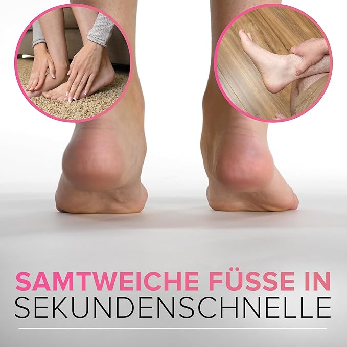 Pedicure Rasp for Dry Hard Skin - Effective Foot File Genuine MEGAFILE Heel Care Callus Remover Dry Dead Skin Egg Corn Sander Scrubber Pumice Stone Alternative Ped Pedi Grater Files Add on Item