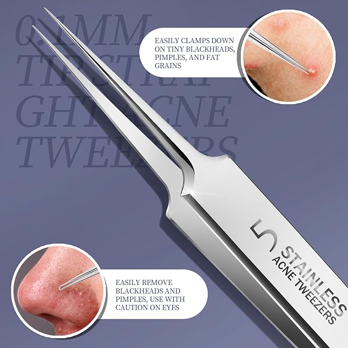 Teenitor 7 Pcs Pimple Popper Tool Kit, Surgical Grade Blackhead Remover Tools, Ingrown Hair Tweezers, Blackhead Extractor Pimple Extractor, Black Head Remover for Face