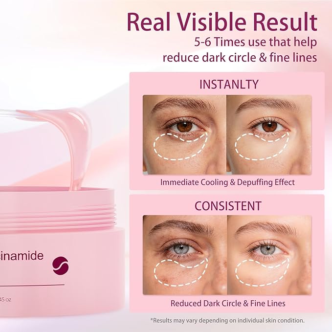 70Pcs Caffeine Peptide Under Eye Patches for Dark Circles Puffiness, Eye Masks with Rose Essence Hyaluronic Acid Niacinamide Anti Wrinkle & Fine Lines Hydrating & Cooling for Women Mothers Day