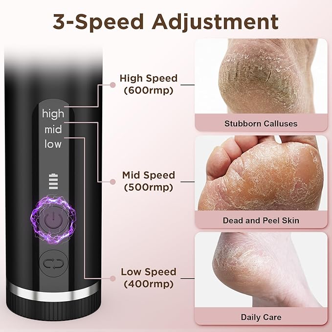 Electric Foot Callus Remover with Nano-Glass Head & 60Pcs Sandpaper Discs, 3 Hours Run Time, Electric Callus Remover for Feet with 3 Adjustable Speeds, Pedicure Tools for Dry Dead Skin Cracked Heels