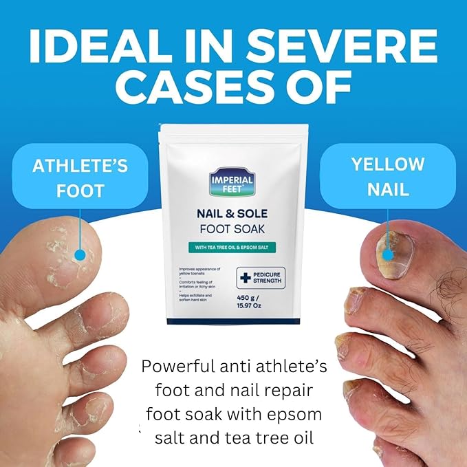 Imperial Feet Epsom Salt Foot Soak (PEDICURE GRADE)-Toenail Repair, Fungus Athletes Foot, Softens Calluses, Tired Feet & Nail Discoloration Foot Soak Salts with Tea Tree Oil 16oz (Green Fungal)