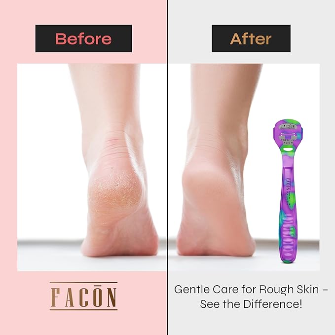 Facón Professional Callus Shaver Remover with 50 Blades, Pedicure Razor for Feet & Hands, Foot Razor for Callus Removal, Callus Blade Remover, Corn Shaver, Surgical Grade Premium Stainless Steel Tool