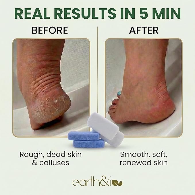 Earth & I Pumice Stone for Feet – 4-Pack Callus Remover Set | 2 Coarse + 2 Fine Dual-Grit Dead Skin Scrubber, Heel Exfoliator & Foot Scrubber for Baby-Soft Feet