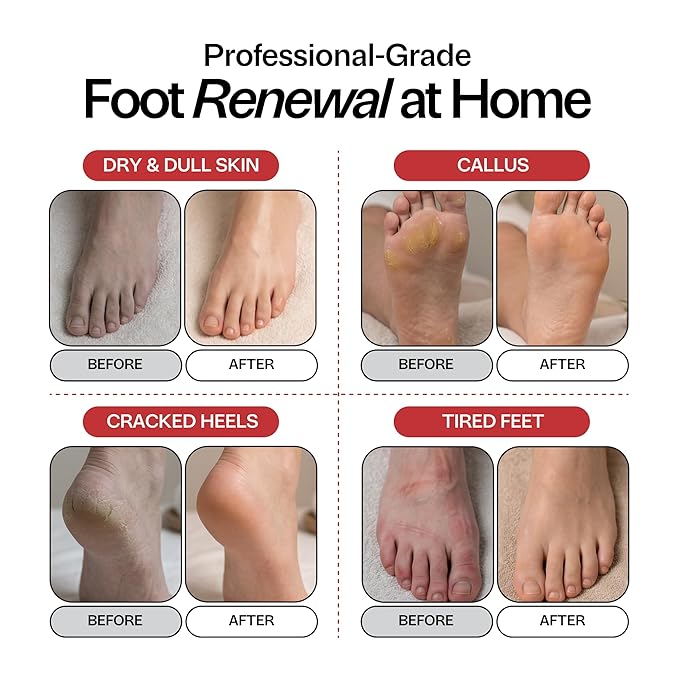 Muscle Soothing Foot Soak with Epsom Salt & Arnica - Relieves Soreness, Eases Tension & Recovery for Athletes - Eucalyptus & Peppermint - 1lb