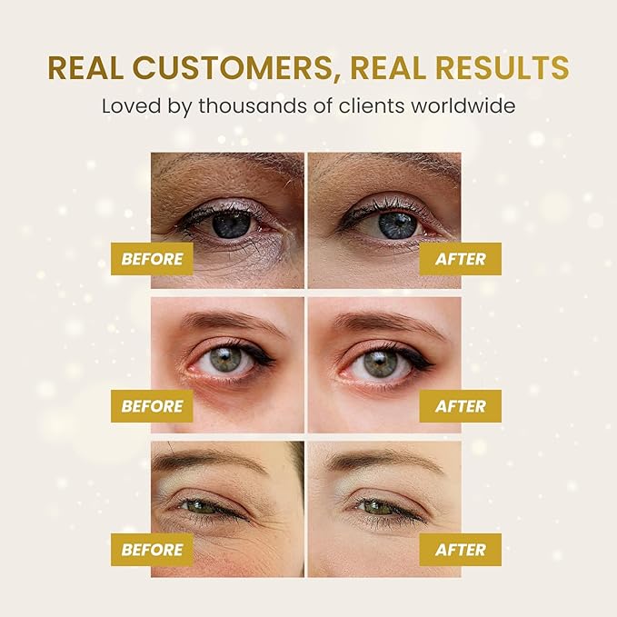 PLANTIFIQUE 24K Gold Under Eye Patches 5 Pairs - Dermatologist Tested - Hydrating Eye Masks Skincare with Collagen, Hyaluronic Acid for Dark Circles & Puffiness