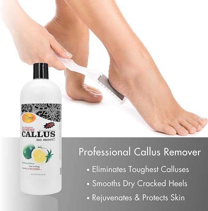 SPA REDI - Callus Remover for Feet Gel - Professional Pedicure Foot Care - Removes Toughest Calluses in Seconds and Smooths Dry Cracked Heels (Lemon and Lime, 32 Oz)