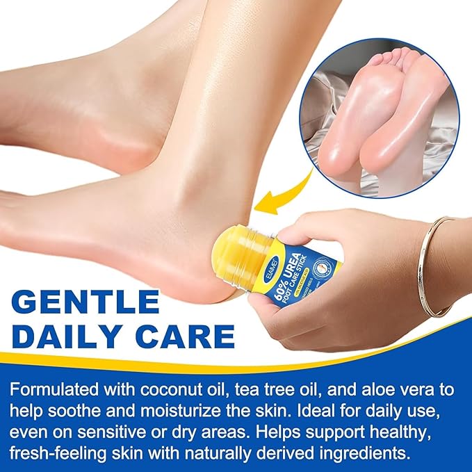 Urea Cream Stick 60% + 2% Salicylic Acid, Foot & Hand Balm for Dry, Cracked Heels & Rough Skin, 60 Percent Urea Lotion for Feet Maximum Strength,Callus Remover & Skin Softener, Soften Dead Skin1.4 oz