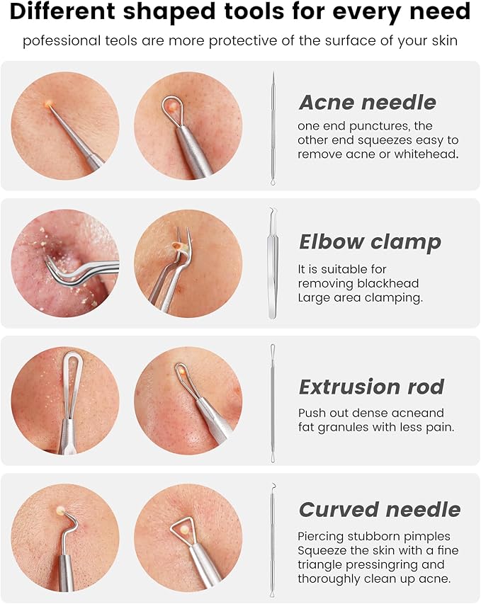 Pimple Popper Tool Kit - Boxoyx 10 Pcs Blackhead Remover Comedone Extractor Kit with Box for Quick and Easy Removal of Pimples, Blackheads, Zit Removing, Forehead,Facial and Nose (New Silver)