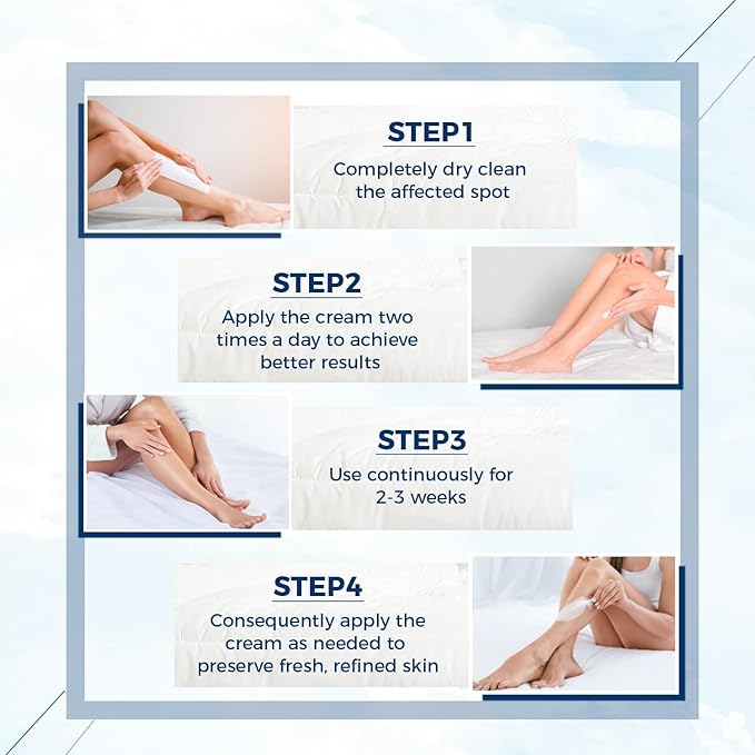 OUKEYA Urea Cream 40 Percent, Foot & Hand Cream for Dry Cracked, Urea Lotion for Feet Maximum Strength(12.35Oz X 4 Packs)