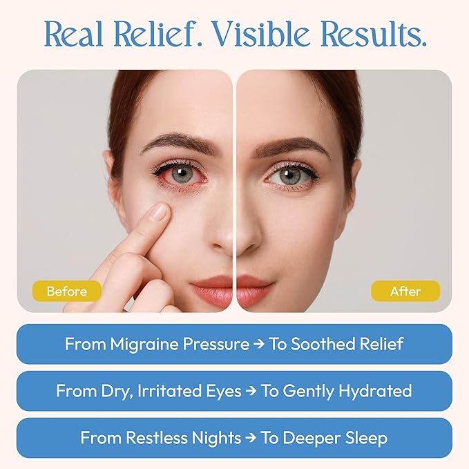 FOMIN Steam Eye Mask for Mothers Day - 20 Pack - Chamomile - Self Heating Warm Compress for Dry Eyes, Heated Eye Mask for Sleep, Puffiness & Dark Circles Relief, Spa Relaxation Gifts for Mom