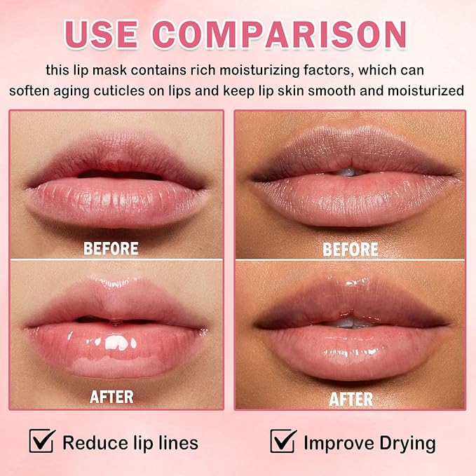 Honey Pot Lip Balm,3PCS Coconut Watermelon Strawberry Lip Balm,Moisturizing and Repair Bee Lip Balm Honey Pot,Prevention Dry and Crack Lip Mask Overnight