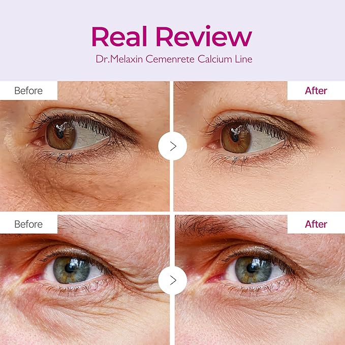 Dr.Melaxin Cemenrete Calcium Volume Eye Patch for Sagging Under Eye Skin, Eye Mask Care for Wrinkles, Puffy Eyes & Dark Circles (60Patches)
