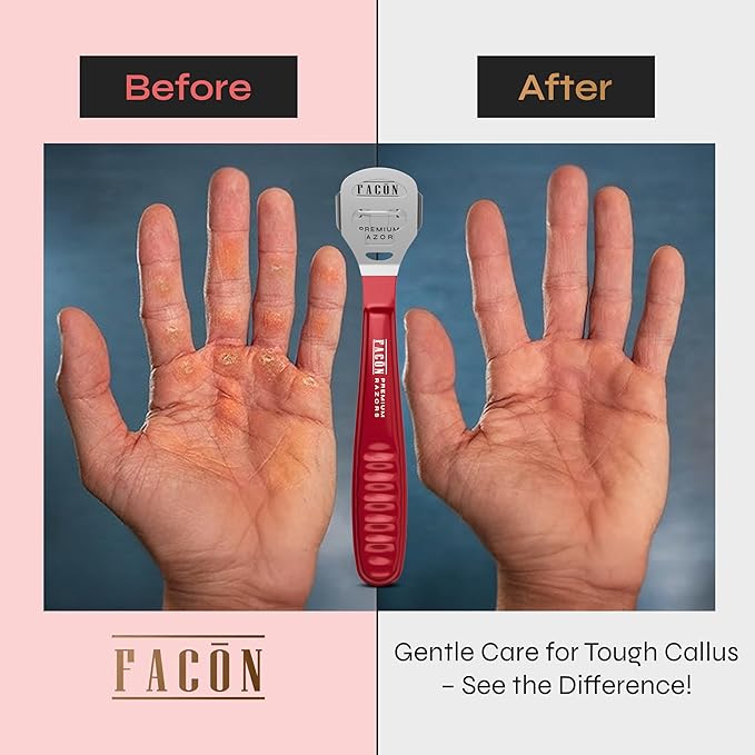 Facón Professional Callus Shaver Remover with 50 Blades, Pedicure Razor for Feet & Hands, Foot Razor for Callus Removal, Callus Blade Remover, Corn Shaver, Surgical Grade Premium Stainless Steel Tool