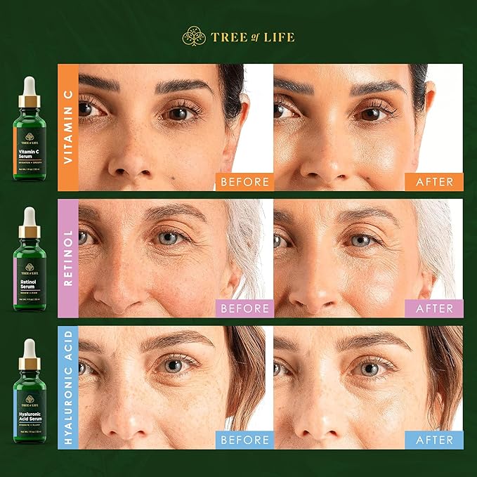 Tree of Life Face Serum Set - Vitamin C, Retinol & Hyaluronic Acid for Brightening, Firming & Hydrating - Anti Aging Skin Care Set - Dermatologist Tested - 1 Fl Oz (Pack of 3) - Mothers Day Gifts