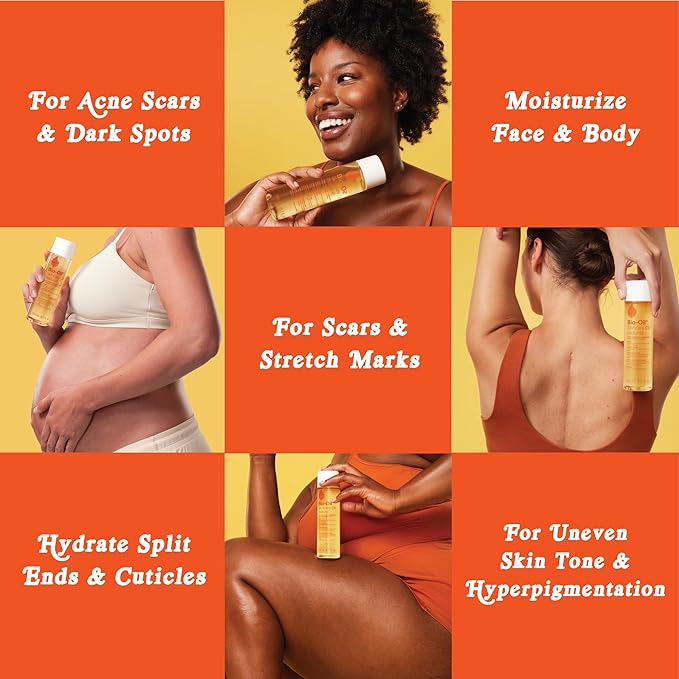Bio-Oil Natural Skincare Oil, Serum for Scars and Stretch Marks, Face and Body Moisturizer for Dry Skin, Hair Oil, For All Skin Types, 4.2 Oz