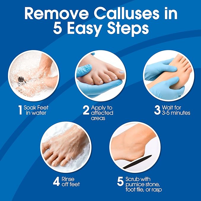 DeEnti Callus Remover for Feet, Extra Strength Foot Callus Remover Gel, 8oz Salon Grade Home Pedicure Supplies for Dry Skin, Cracked Heel, Professional Strength Foot Care, Unscented