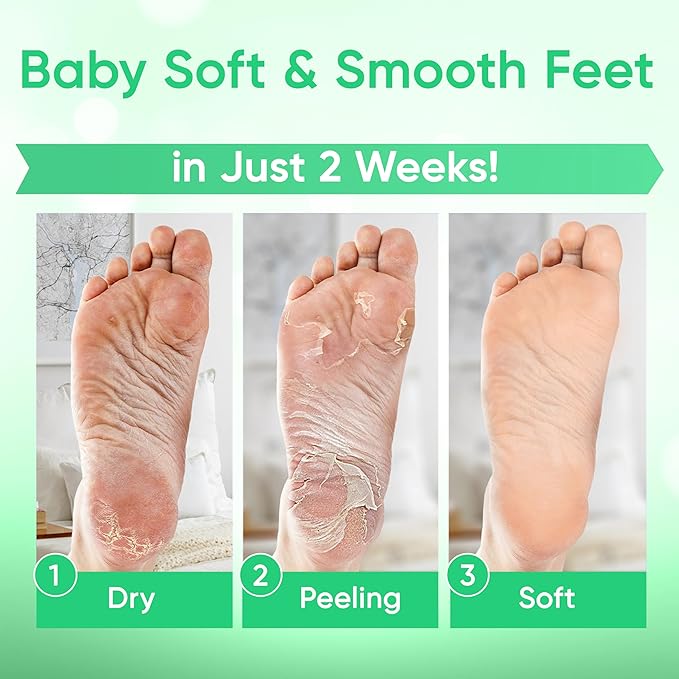 Foot Peel Mask - Foot Mask for Baby Soft Skin - Remove Dead Skin, Dry, Cracked Feet & Callus, Foot Spa, Made with Aloe Vera Extract for Women and Men (2 Pairs) | Peppermint