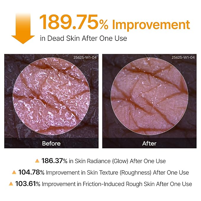 Dr.Melaxin Body Keratin Care Kojic Acid Turmeric Spray with AHA & PHA, Gentle Body Brightening & Exfoliating Peeling Solution for Dead Skin Cells & Texture, Korean Skincare, 6.76 fl.oz