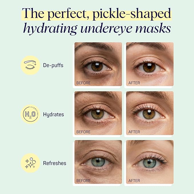 SpaLife In a Pickle Hydrogel Under Eye Patches for Dark Circles | Mothers Day Gifts | Pickle Under Eye Patches for Puffy Eyes | Hydrating Undereye Masks | Pack of 8 Pairs (8 Undereye Treatments)
