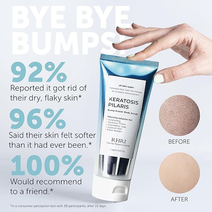 KP Bump Eraser Body Scrub with 10% AHA | Keratosis Pilaris Treatment | Bump Eraser Body Scrub | Ingrown Hair Treatment | Clears Strawberry Legs | Soothes Redness, Dryness & Flaky Skin