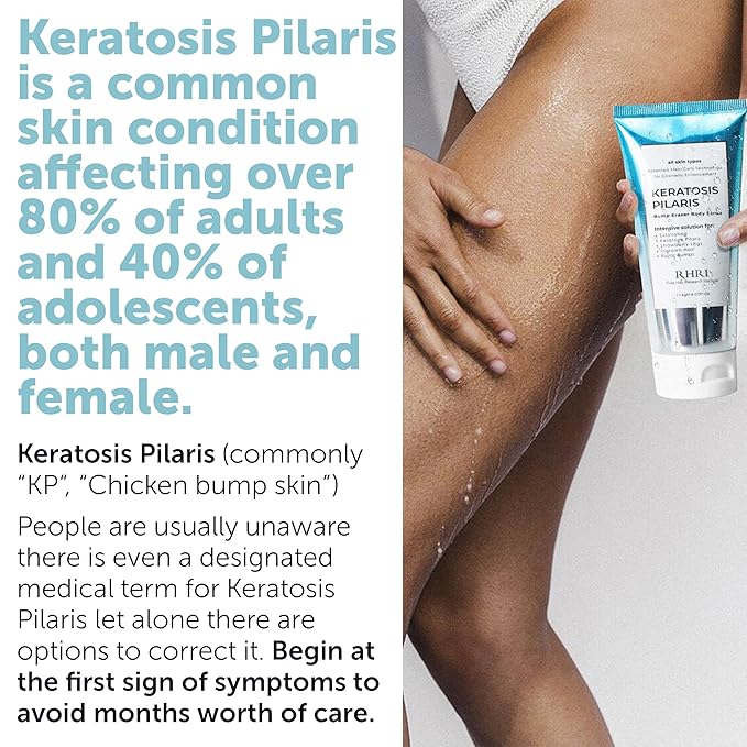 KP Bump Eraser Body Scrub with 10% AHA | Keratosis Pilaris Treatment | Bump Eraser Body Scrub | Ingrown Hair Treatment | Clears Strawberry Legs | Soothes Redness, Dryness & Flaky Skin