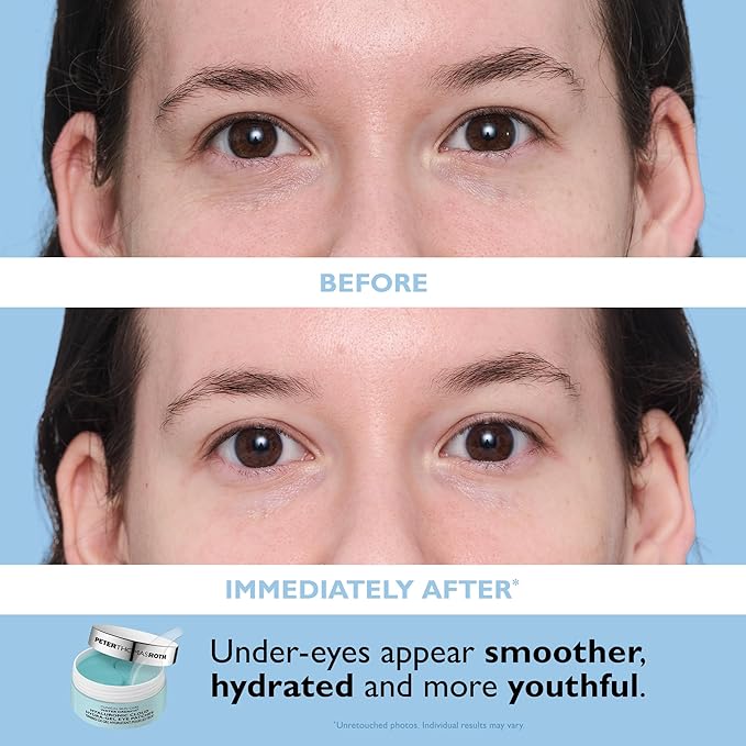 Peter Thomas Roth | Full-Size Vitamin C & Hyaluronic Eye Patches 2-Piece Kit